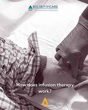How Does Infusion Therapy Work?